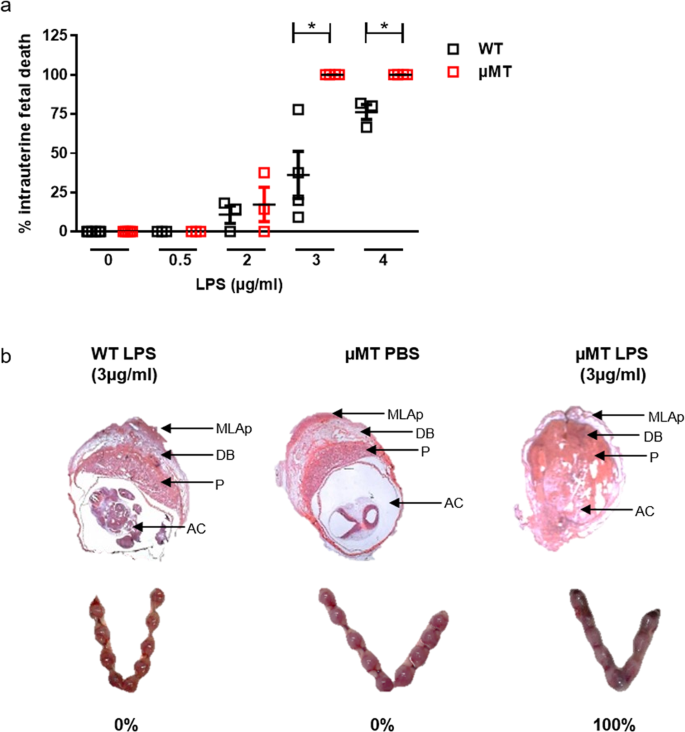 Il 10 Producing B Cells Rescue Mouse Fetuses From Inflammation Driven Fetal Death And Are Able To Modulate T Cell Immune Responses Scientific Reports