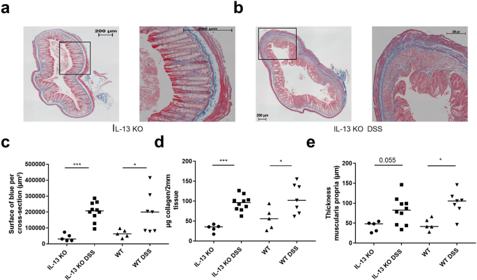 Fibrogenesis in Chronic DSS Colitis is Not Influenced by Neutralisation of  Regulatory T Cells, of Major T Helper Cytokines or Absence of IL-13 |  Scientific Reports