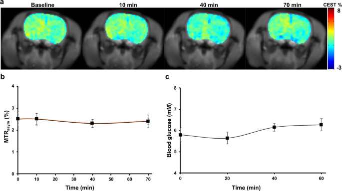 Sugar alcohol provides imaging contrast in cancer detection | Scientific Reports Sugar alcohol provides imaging contrast in cancer detection | Scientific Reports