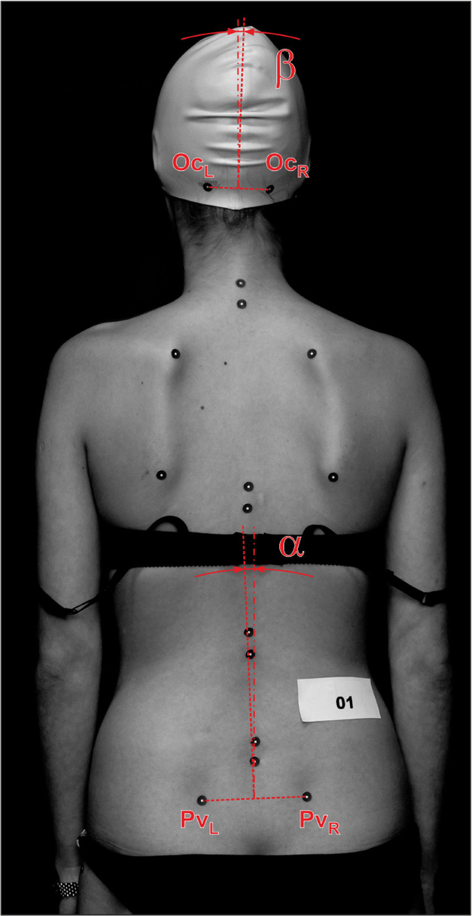 Posture correctness of young <b>female</b> soccer players | Scientific ...
