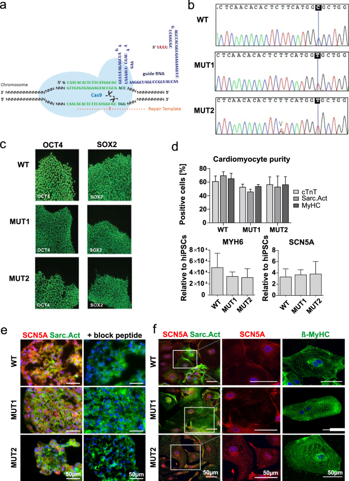 Comparing Human Ipsc Cardiomyocytes Versus Hek293t Cells Unveils Disease Causing Effects Of Brugada Mutation 35v Of Na V 1 5 Sodium Channels Scientific Reports