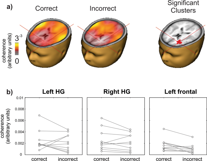 Neural Indices Of Listening Effort In Noisy Environments Scientific Reports