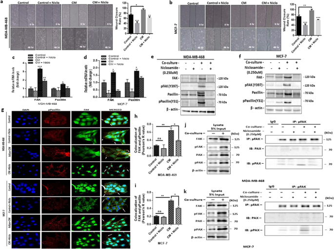 Niclosamide Reverses Adipocyte Induced Epithelial Mesenchymal Transition In Breast Cancer Cells Via Suppression Of The Interleukin 6 Stat3 Signalling Axis Scientific Reports