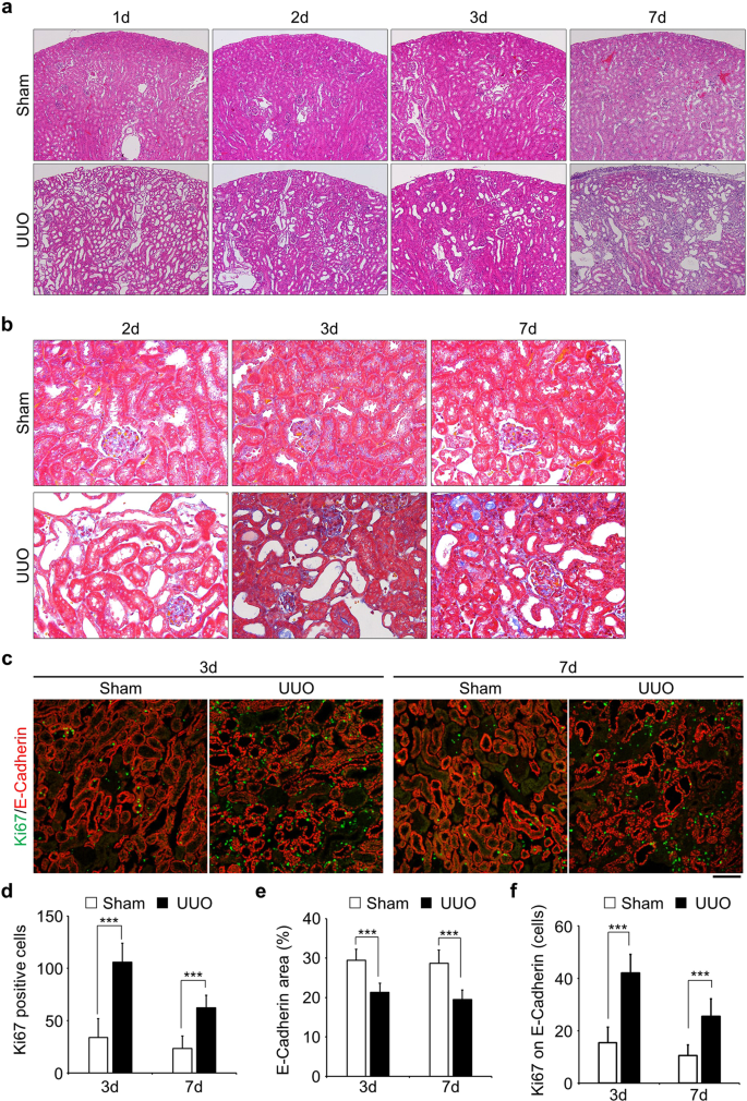 The p21 dependent G2 arrest of the cell cycle in epithelial tubular cells  links to the early stage of renal fibrosis | Scientific Reports