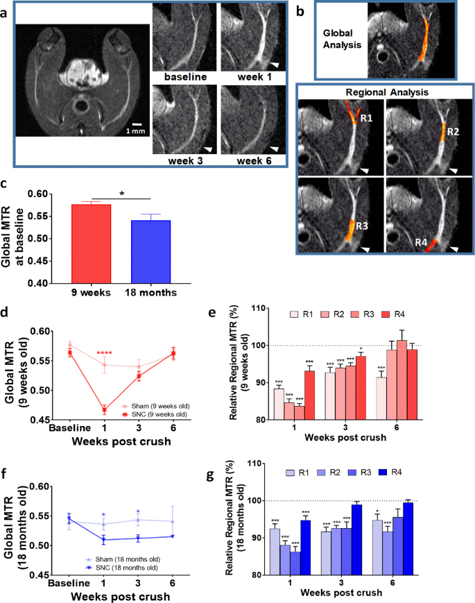 Magnetic Resonance Imaging as a Biomarker in Rodent Peripheral Nerve Injury  Models Reveals an Age-Related Impairment of Nerve Regeneration | Scientific  Reports