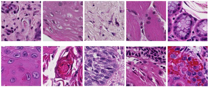 Head and Neck Cancer Detection in Digitized Whole-Slide Histology Using  Convolutional Neural Networks | Scientific Reports