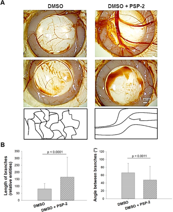 High Affinity Cu I Chelator Psp 2 As Potential Anti Angiogenic Agent Scientific Reports