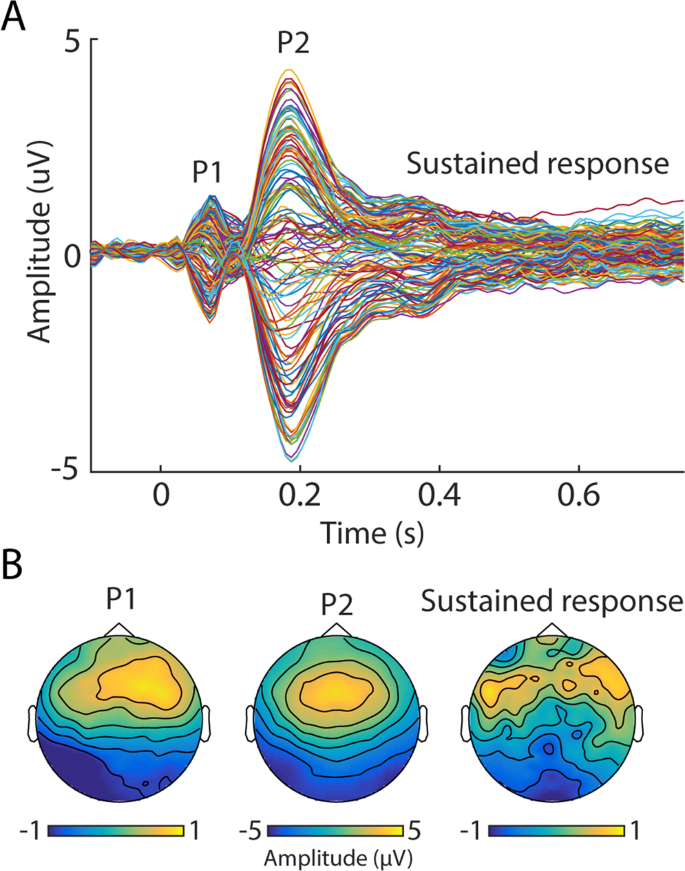 Rapid Brain Responses to Familiar vs. Unfamiliar Music – an EEG and  Pupillometry study | Scientific Reports