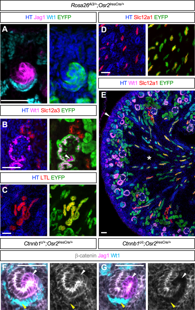 B Catenin Regulates The Formation Of Multiple Nephron Segments In The Mouse Kidney Scientific Reports