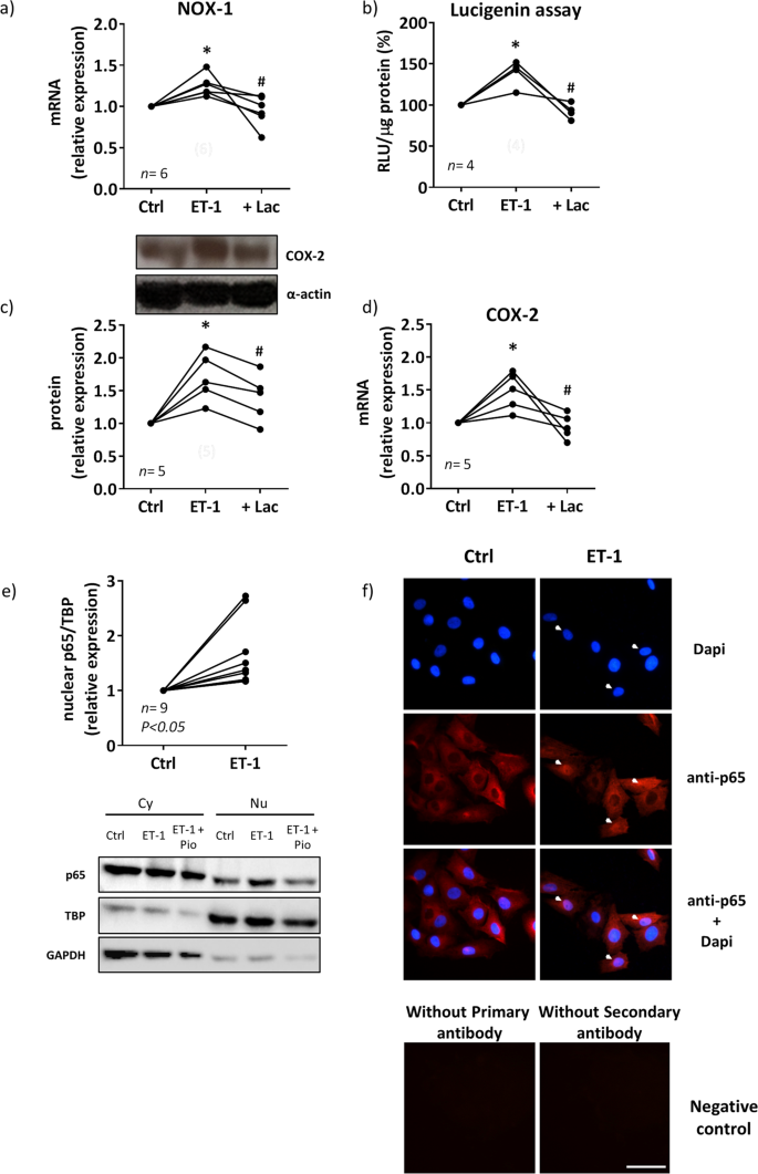 Pioglitazone Modulates the Vascular Contractility in Hypertension by Interference ET-1 Pathway | Reports