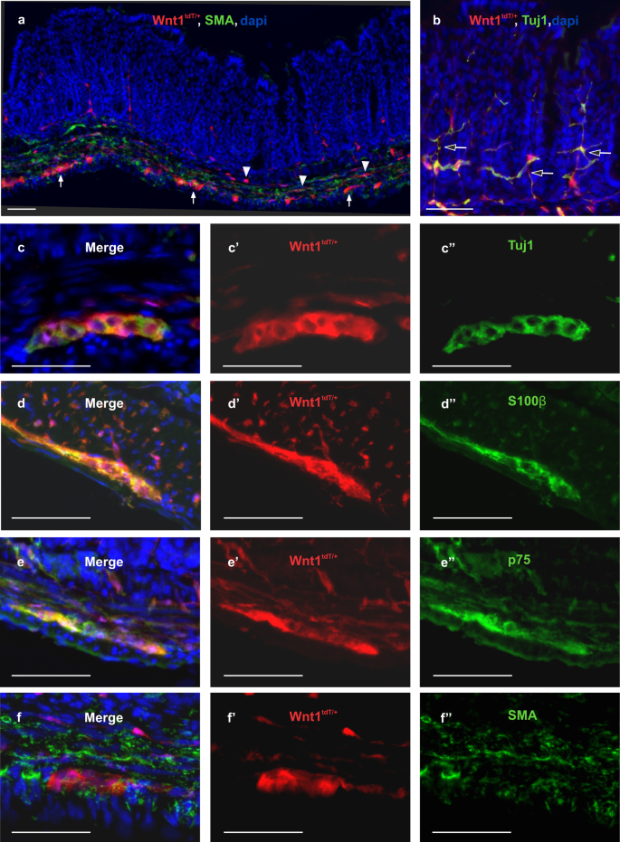 Enteric Neuronal Cell Therapy Reverses Architectural Changes In A Novel Diphtheria Toxin Mediated Model Of Colonic Aganglionosis Scientific Reports