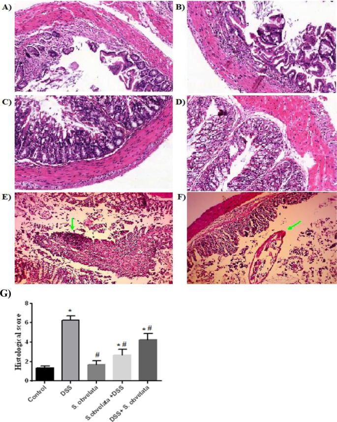 pinworms és colitis)