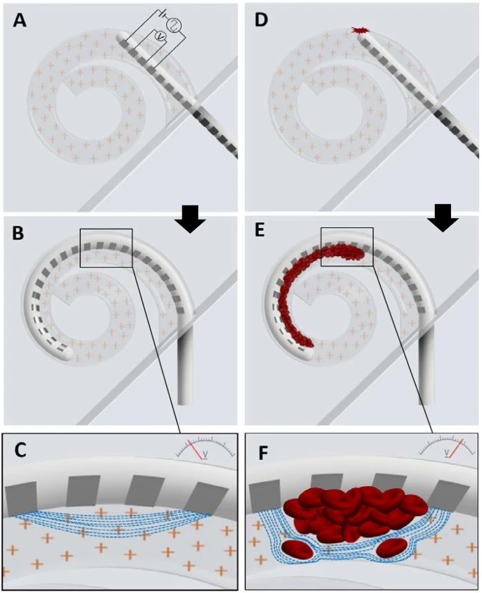 Four-point impedance monitoring during cochlear implant surgery showing trauma detection