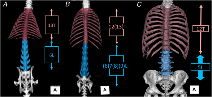 Thoracic Vertebra cookie cutter Medical Science Human Spine Anatomy Birthday 