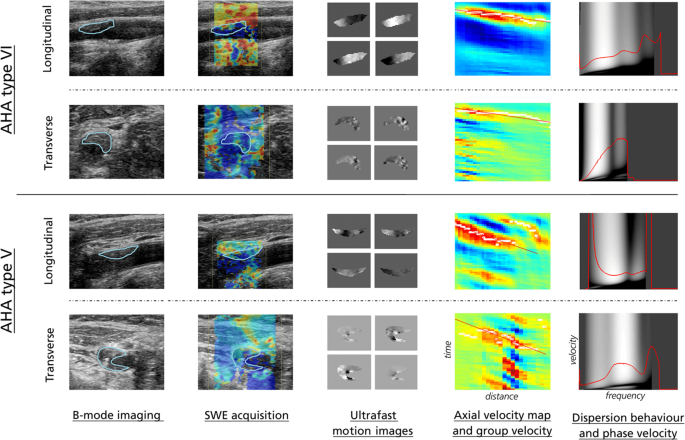 Longitudinal v L , transverse v T , and average ⟨v⟩ velocities