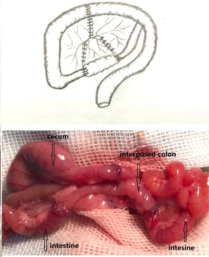 Enhancement of Colonic Absorptive Function after the Massive Resection of  the Small Intestine Based on the Creation of an Artificial Colonic Valve |  Scientific Reports
