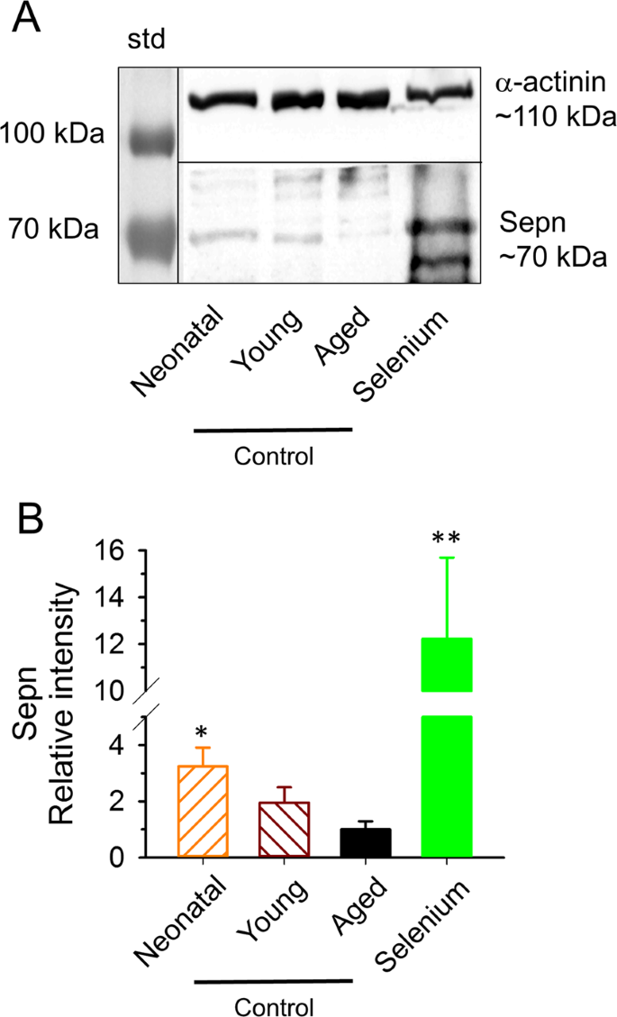 Improved Calcium Homeostasis and Force by Selenium Treatment and Training  in Aged Mouse Skeletal Muscle | Scientific Reports