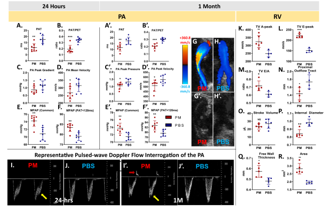 World Trade Center Cardiorespiratory And Vascular Dysfunction Assessing The Phenotype And Metabolome Of A Murine Particulate Matter Exposure Model Scientific Reports