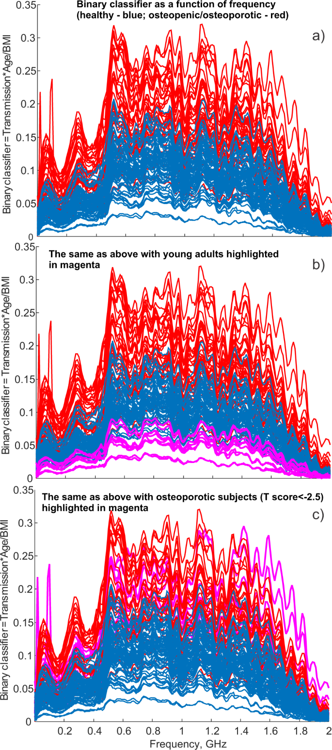 Concept Of A Radiofrequency Device For Osteopenia Osteoporosis Screening Scientific Reports
