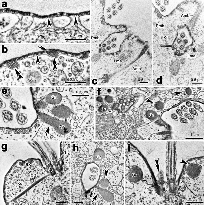 Documentation Of A New Hypotrich Species In The Family Amphisiellidae Lamtostyla Gui N Sp Protista Ciliophora Using A Multidisciplinary Approach Scientific Reports