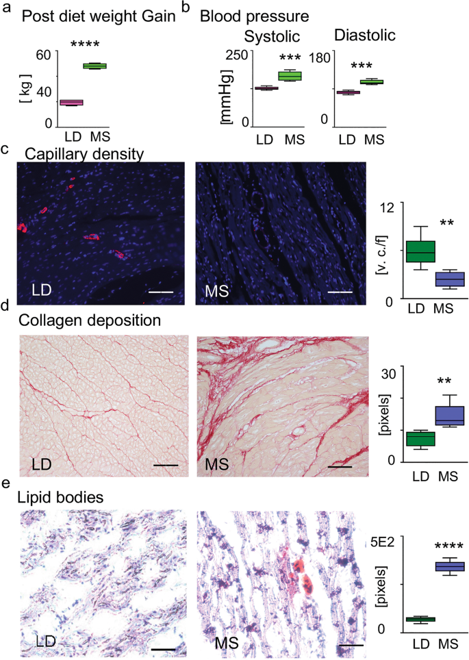 Metabolomics And The Pig Model Reveal Aberrant Cardiac Energy Metabolism In Metabolic Syndrome Scientific Reports