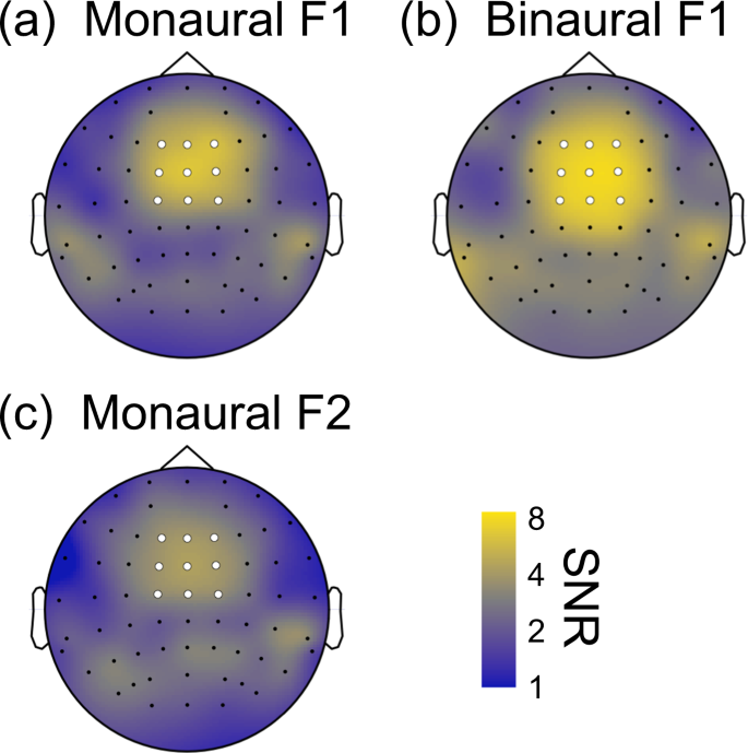 Simulated Human Evoked Response Audiometry (SimHERA)