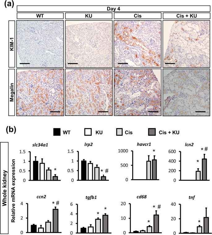 pharmacological inhibition of ataxia