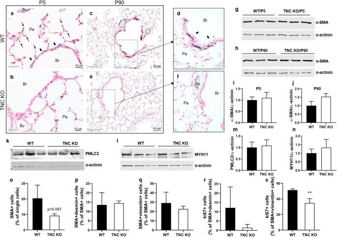 Tenascin C Inactivation Impacts Lung Structure And Function Beyond Lung Development Scientific Reports