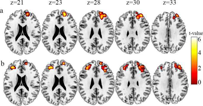 Locating Neural Transfer Effects Of N Back Training On The Central Executive A Longitudinal Fmri Study Scientific Reports