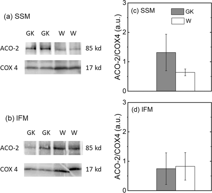 Bioenergetic Functions In Subpopulations Of Heart Mitochondria Are Preserved In A Non Obese Type 2 Diabetes Rat Model Goto Kakizaki Scientific Reports