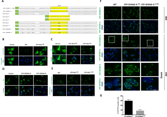 SPANX-A/D protein subfamily plays a key role in nuclear organisation,  metabolism and flagellar motility of human spermatozoa | Scientific Reports