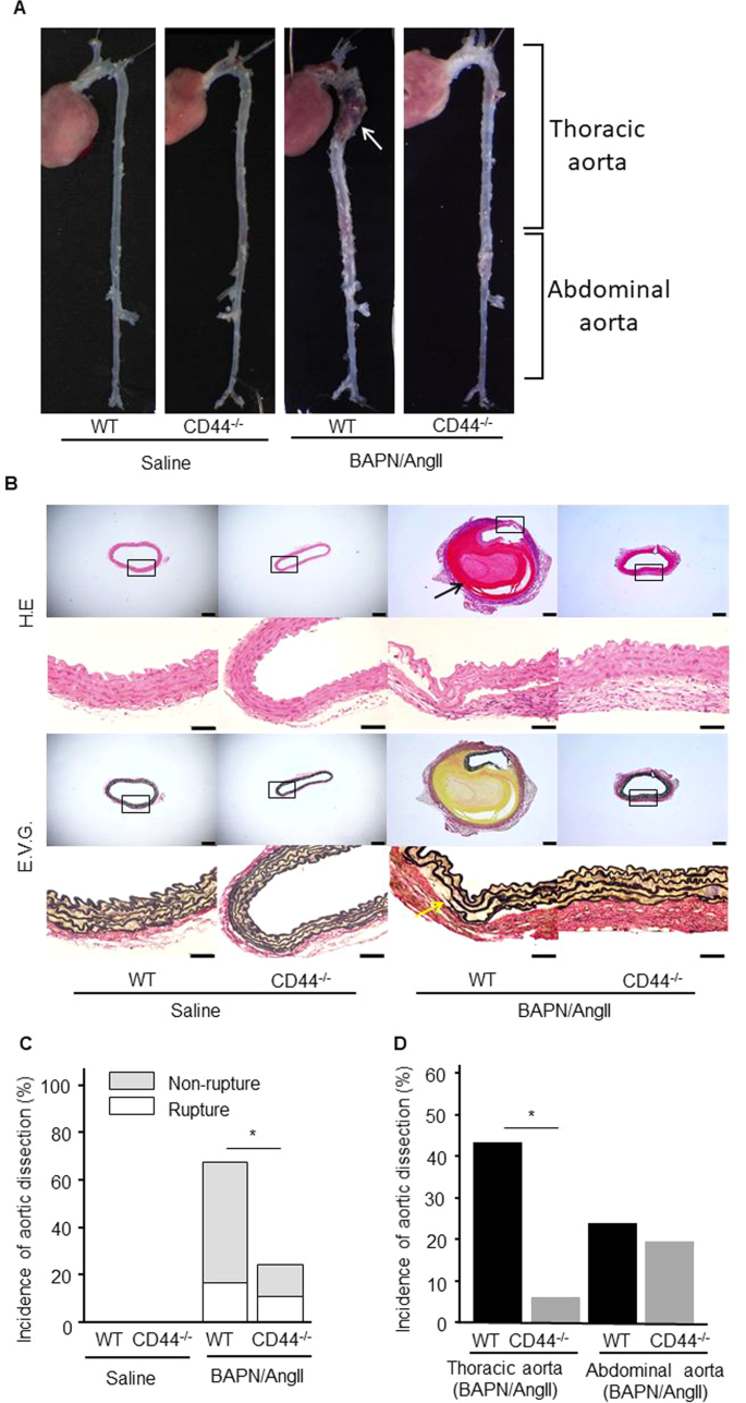 Deficiency of CD44 prevents thoracic aortic dissection in a murine model |  Scientific Reports