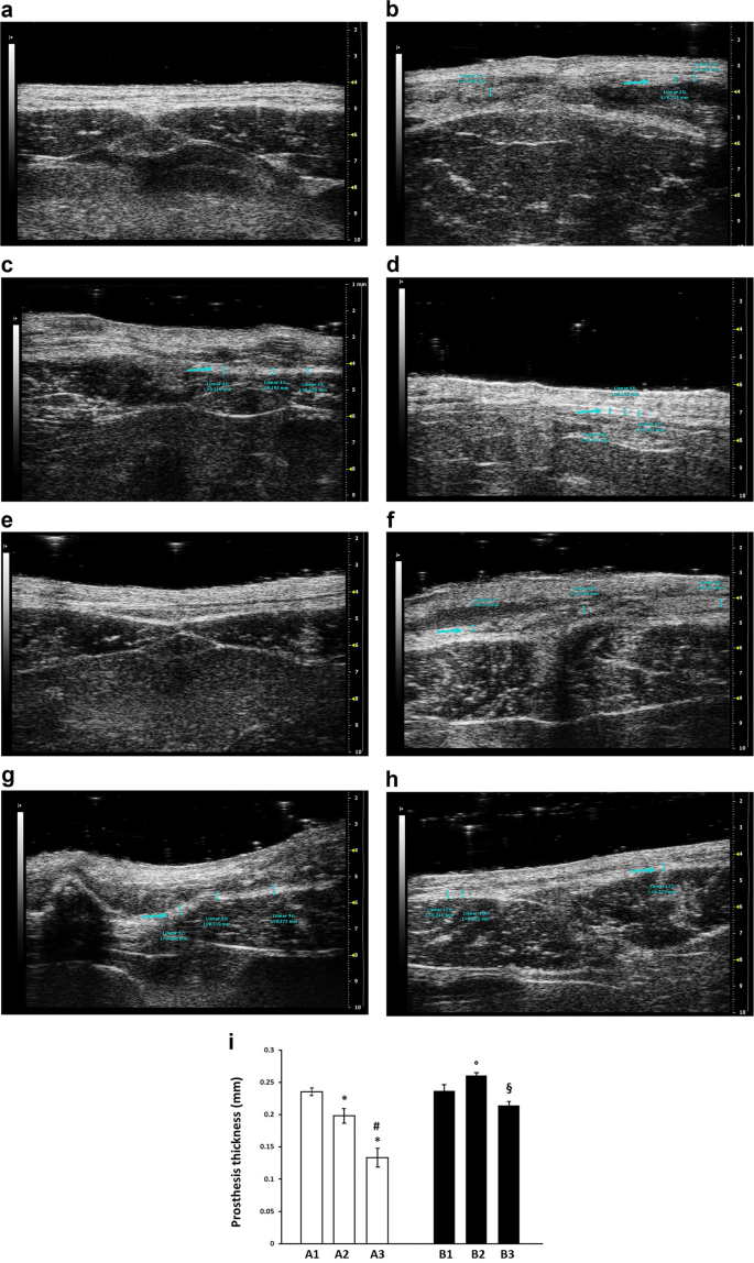 Bridging repair of the abdominal wall in a rat experimental model.  Comparison between uncoated and polyethylene oxide-coated equine pericardium  meshes | Scientific Reports