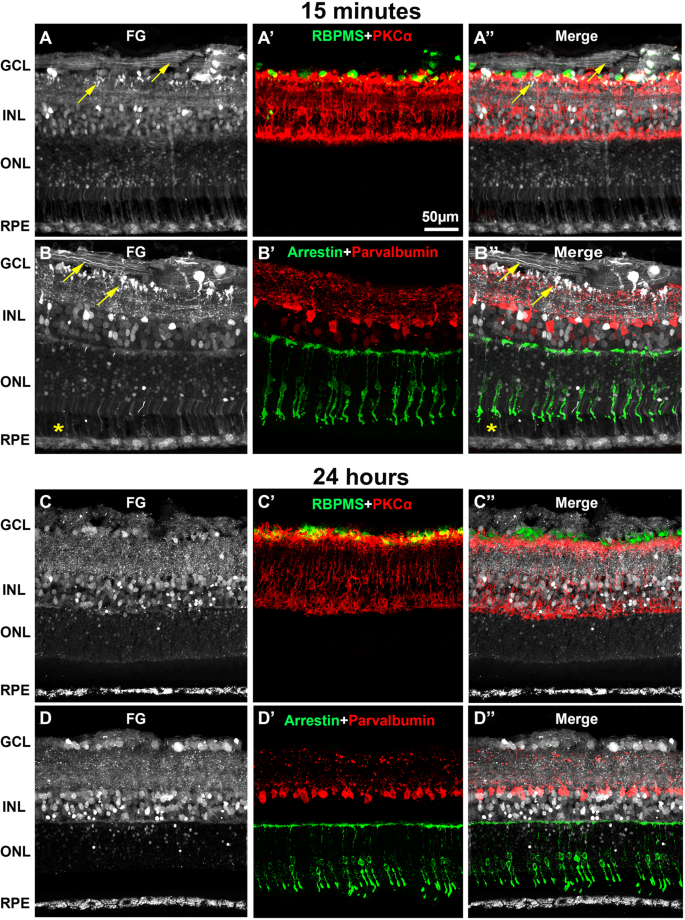 The retina and retinal pigment epithelium (RPE)