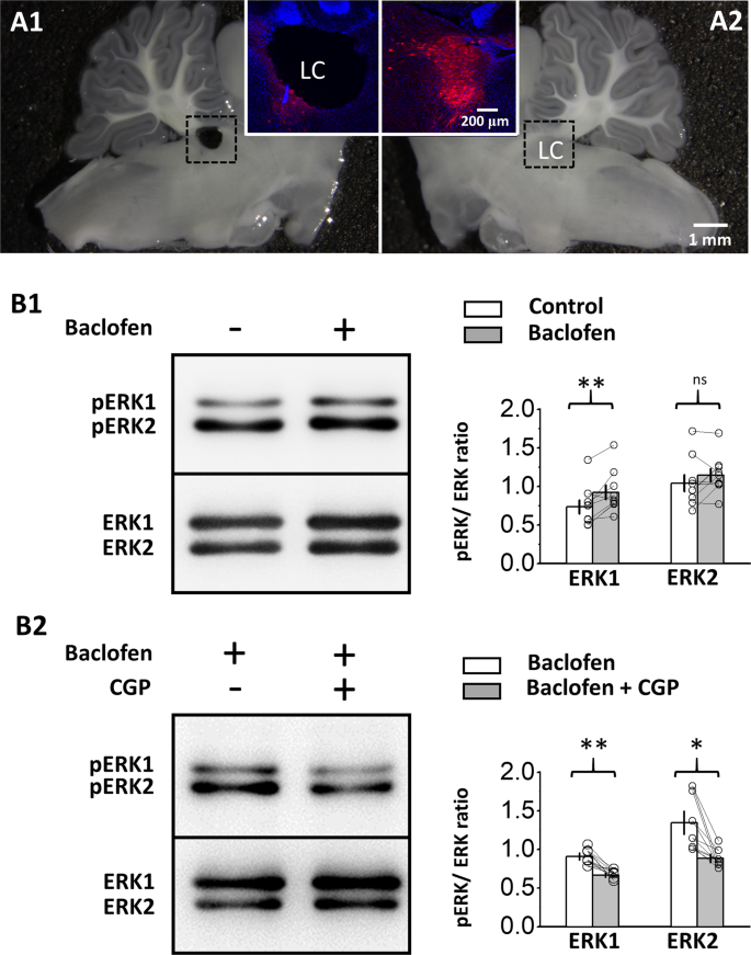 Extracellular Signal Regulated Kinases Mediate An Autoregulation Of Gabab Receptor Activated Whole Cell Current In Locus Coeruleus Neurons Scientific Reports Extracellular Signal Regulated Kinases Mediate An Autoregulation Of Gabab Receptor Activated Whole Cell Current In Locus Coeruleus Neurons Scientific Reports