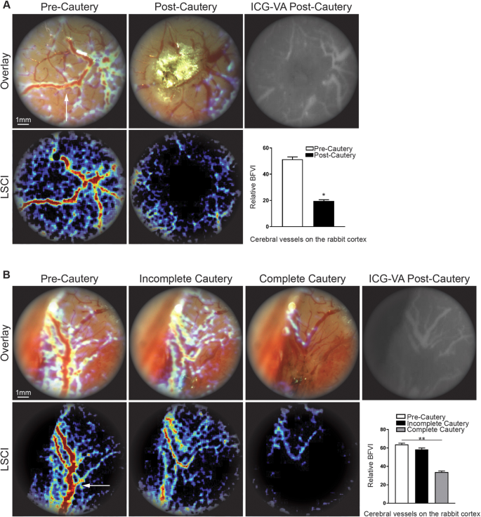 Intraoperative Laser Speckle Contrast Imaging For Real-Time Visualization  of Cerebral Blood Flow in Cerebrovascular Surgery: Results From  Pre-Clinical Studies | Scientific Reports