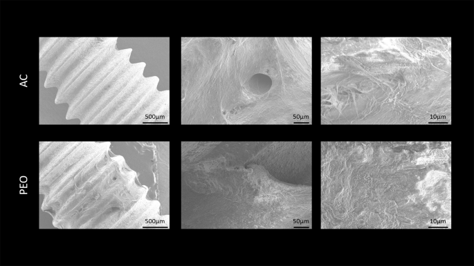 Plasma Electrolytic Oxidation as a Feasible Surface Treatment for Biomedical Applications: an in vivo study | Scientific Reports Plasma Electrolytic Oxidation as a Feasible Surface Treatment for Biomedical Applications: an in vivo study | Scientific Reports