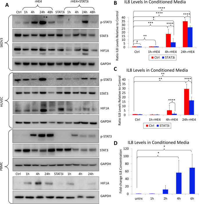 The biomarker HE4 (WFDC2) promotes a pro-angiogenic and ...