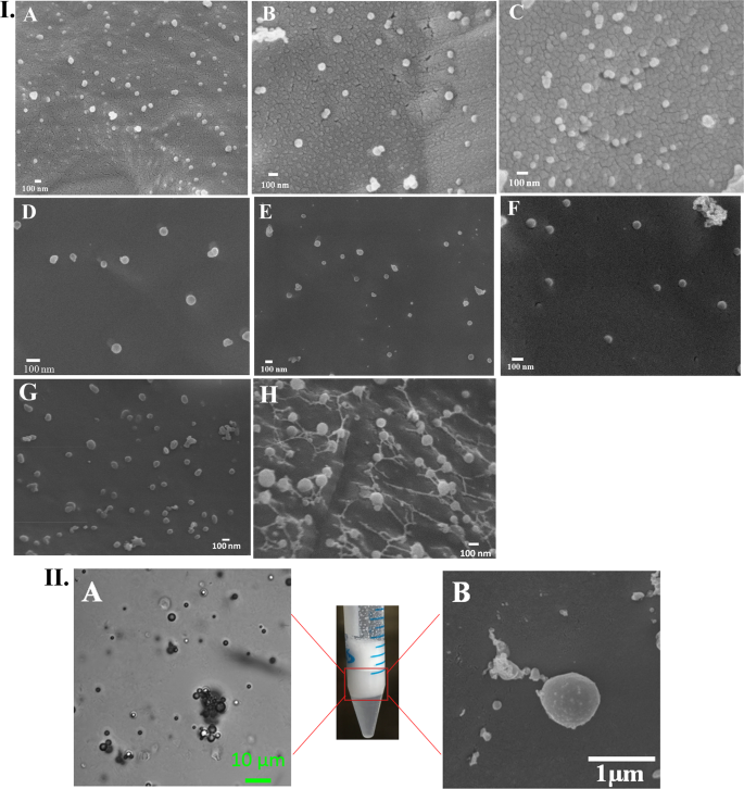 Curcumin Encapsulated Lecithin Nanoemulsions An Oral Platform For Ultrasound Mediated Spatiotemporal Delivery Of Curcumin To The Tumor Scientific Reports