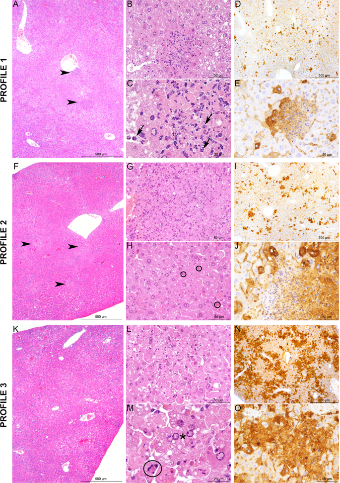 Genetic dissection of Rift Valley fever pathogenesis: Rvfs2 locus on mouse  chromosome 11 enables survival to early-onset hepatitis | Scientific Reports