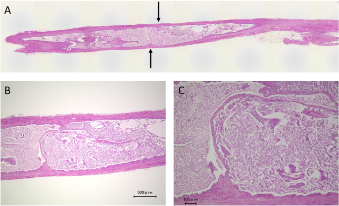 Internal Mammary Vein Valves: A Histological Study | Scientific Reports