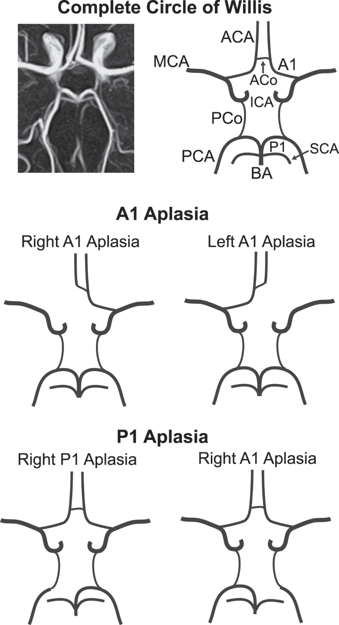 Quantitative Analysis of the Cerebral Vasculature on Magnetic Resonance  Angiography | Scientific Reports