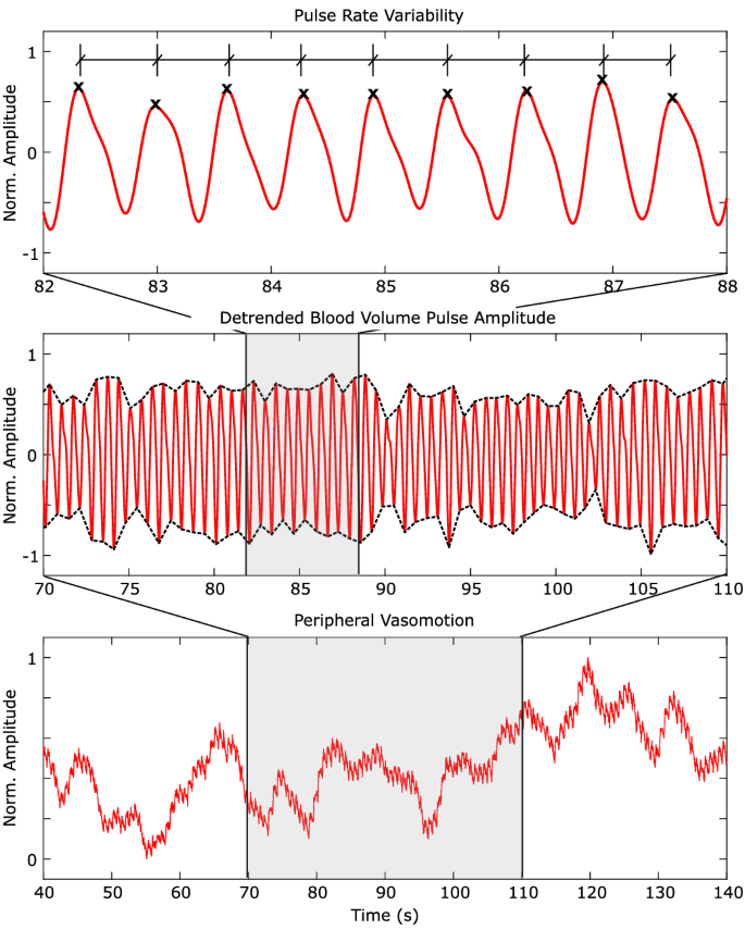 Non-contact imaging of peripheral hemodynamics during cognitive and  psychological stressors | Scientific Reports