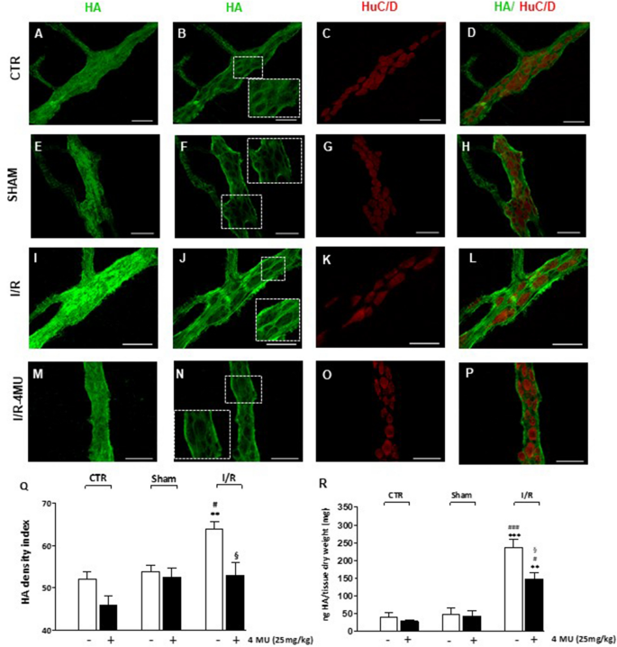 Involvement Of Hyaluronan In The Adaptive Changes Of The Rat Small Intestine Neuromuscular Function After Ischemia Reperfusion Injury Scientific Reports