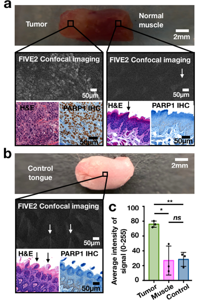 Fluorescence-guided resection of tumors in mouse models of oral cancer |  Scientific Reports