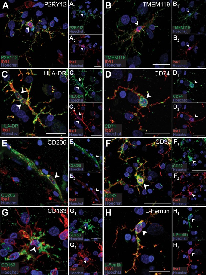 Quantitative immunohistochemical analysis of myeloid cell marker expression  in human cortex captures microglia heterogeneity with anatomical context |  Scientific Reports