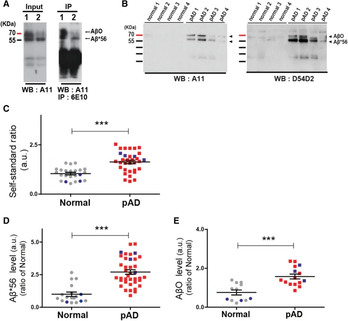 Longitudinal profiling of oligomeric Aβ in human nasal discharge reflecting cognitive decline in probable Alzheimer’s disease