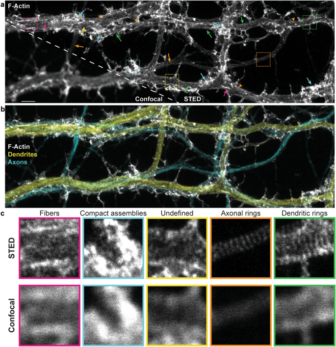 Neuronal activity remodels the F-actin based submembrane lattice in  dendrites but not axons of hippocampal neurons | Scientific Reports