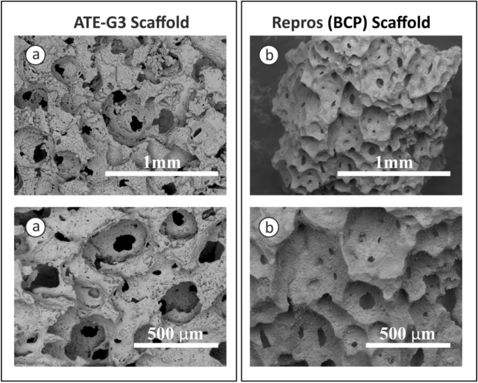 Novel antimicrobial phosphate-free glass–ceramic scaffolds for bone tissue  regeneration | Scientific Reports