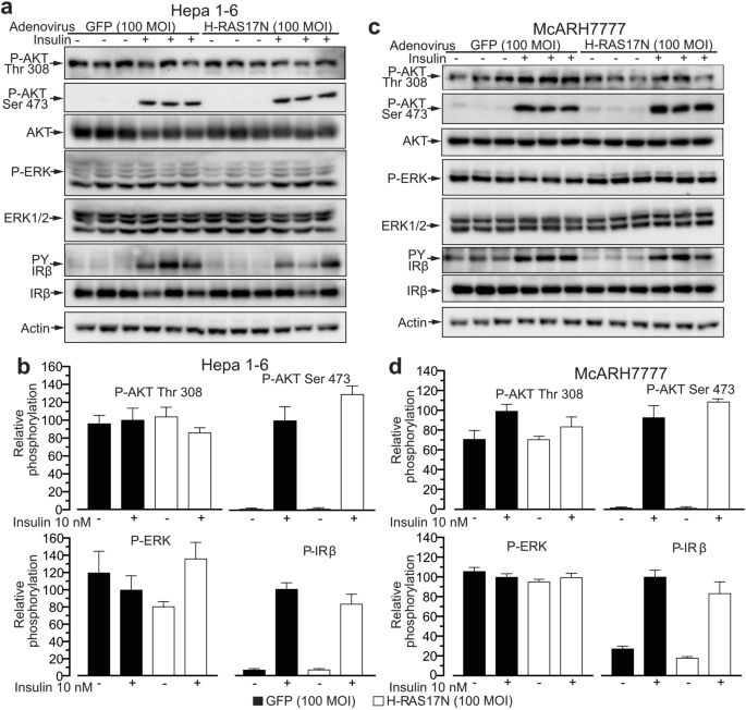 Insulin Signaling And Glucose Metabolism In Different Hepatoma Cell Lines Deviate From Hepatocyte Physiology Toward A Convergent Aberrant Phenotype Scientific Reports